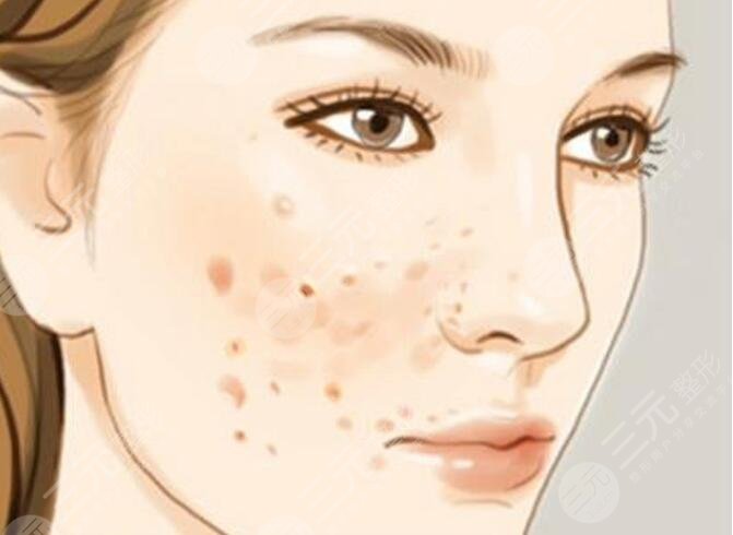 大蒜擦臉祛斑的注意事項(xiàng)