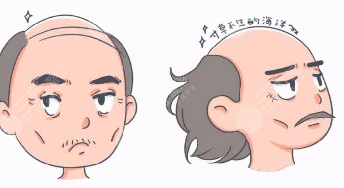 生姜能緩解脫發(fā)嗎？怎么正確使用不傷頭皮？詳細(xì)操作方法告訴你！