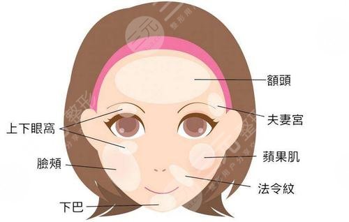 玻尿酸豐面頰需要多少?錢?