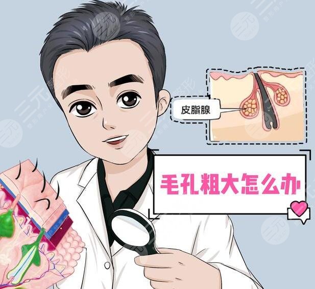 　　男性毛孔粗大怎么辦?這種方式其實(shí)是很不錯(cuò)的，而且能夠讓整個(gè)人的皮膚狀態(tài)看上去更加的美觀，能夠更好的改良毛孔粗大的問題，從而讓整個(gè)人的肌膚狀態(tài)看上去更加的精美和自然。其實(shí)很多的男性毛孔都是比較粗大的，想要更好的改良方式也是較多的，可以根據(jù)自己的皮膚狀態(tài)選擇更加適合的方式進(jìn)行緩解，也可以去專業(yè)的醫(yī)院進(jìn)行一定的咨詢，下面我們一起來了解了解男性毛孔粗大怎么辦?  　　一、男性毛孔粗大怎么辦?  　　男生毛孔粗大，可以在專業(yè)醫(yī)生的指導(dǎo)下，使用局部的外用藥物進(jìn)行改良，同時(shí)也可以采用光子嫩膚的方式進(jìn)行一定的調(diào)節(jié)。還可以使用果酸，煥膚等方式進(jìn)行一定的緩解，這幾種操作方式都并不是特別的繁瑣和復(fù)雜，能夠讓整個(gè)人的皮膚狀態(tài)看上去更加的美觀。  　　1、局部使用藥物。其實(shí)局部的使用藥物能夠讓整個(gè)人的皮膚看上去更加的年輕化和光滑，一般不會(huì)出現(xiàn)劇烈的刺痛感和疼痛感，反而能夠讓肌膚狀態(tài)看上去更加的年輕化和自然化，改良了肌膚衰老的感覺。當(dāng)男生毛孔過于粗大時(shí)，可以使用一些維a酸乳膏或者是水楊酸乳膏進(jìn)行一定的涂抹，能夠讓肌膚看上去更加的年輕化，加速角質(zhì)的排出，溶解角質(zhì)，因此能夠更好的改良毛孔粗大等方面的問題，從而讓整個(gè)人的皮膚狀態(tài)看上去更加的光滑，也能夠讓個(gè)人的氣質(zhì)得到一定的提升。  　　2、光子嫩膚。當(dāng)毛孔粗大時(shí)，可以在專業(yè)醫(yī)生的指導(dǎo)下，利用光子嫩膚產(chǎn)生的強(qiáng)脈沖光能量，因此能夠讓整個(gè)人的皮膚狀態(tài)看上去更加的年輕化，而且在處理的過程中整個(gè)人的膠原蛋白能夠得到一定的提升，纖維蛋白源也會(huì)增多，一般是不會(huì)出現(xiàn)不適癥狀的。做緩解的過程中，能達(dá)到皮膚深層組織，玩更好的抑制皮膚表面細(xì)菌繁殖，并且也能夠減少油脂分泌，因此通過做該緩解能夠縮小毛孔并且改良毛孔粗大的現(xiàn)象，讓整個(gè)人的皮膚看上去更加的光滑，也能夠讓肌膚看上去更加的年輕化，改良衰老的感覺，從而提升個(gè)人的氣質(zhì)。  　　3、果酸換膚。果酸換膚緩解，是利用高濃度的果酸對(duì)皮膚進(jìn)行剝離，通過做該緩解，不僅能夠讓皮膚狀態(tài)看上去更加的年輕化，同時(shí)還可以使老化的角質(zhì)層脫落，能夠促進(jìn)新的細(xì)胞再次生長，因此采用這種方式能夠更好的美白自己的肌膚，同時(shí)也能夠讓個(gè)人的肌膚狀態(tài)看上去更加的年輕化，從而縮小毛孔。  　　二、男性收縮毛孔的注意事項(xiàng)  　　男生毛孔粗大需要做好面部的護(hù)理工作，不要在陽光下進(jìn)行暴曬，否則可能會(huì)出現(xiàn)劇烈的刺痛感和疼痛感，而且在出門的時(shí)候也要記得對(duì)肌膚進(jìn)行一定的防曬，可以適當(dāng)?shù)耐磕ǚ罆袼⑶乙部梢源蛘陉杺慊蛘呤谴┓罆褚?。想要讓自己毛孔粗大的現(xiàn)象得到更好的改良，而且對(duì)于臉部的清潔和護(hù)理是要更加的注重每天，都可以用溫水洗臉，能夠清除臉部的大部分雜質(zhì)和雜菌，同時(shí)也要注重臉部的補(bǔ)水。