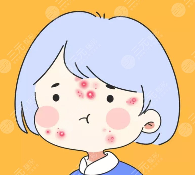 去痘印的注意事項