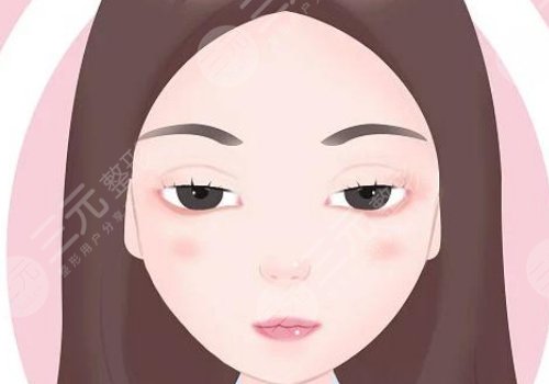 上瞼下垂矯正大概需要多少費用?