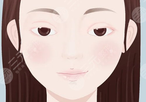 上瞼下垂矯正大概需要多少費用?