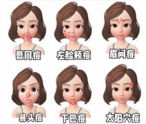 下巴長(zhǎng)痘是怎么回事？3種原因分析，科普帶你做好戰(zhàn)痘準(zhǔn)備！