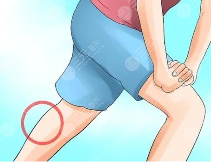 小腿吸脂手術(shù)價(jià)格多少錢2023？手術(shù)注意事項(xiàng)說明，擁有漫畫版修長腿！