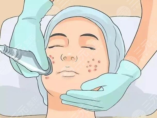 痤瘡生長(zhǎng)的原因是什么呢?