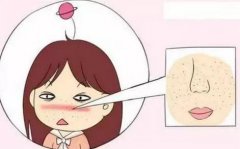 專業(yè)彩光嫩膚祛斑怎么樣？原理優(yōu)點(diǎn)介紹+價(jià)格參考！醫(yī)美入門指南~