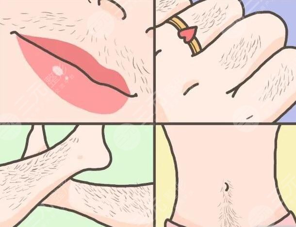 小腿激光脫毛的注意事項(xiàng)