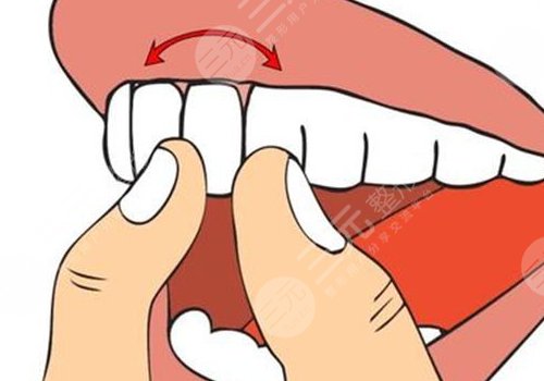 牙齒松動有什么辦法恢復(fù)?