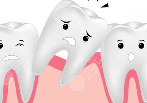 牙齒松動有什么辦法恢復(fù)?