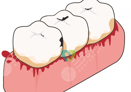 牙齒松動有什么辦法恢復(fù)?