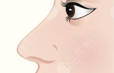 鼻子整形可以維持一輩子嗎？10年、20年后怎么辦？鼻科醫(yī)生告訴你實(shí)情！