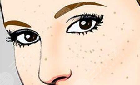 蜂蜜祛斑的小竅門是什么？具體制作操作大全記錄，長(zhǎng)期堅(jiān)持有！