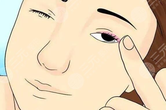 眼部脂肪粒如何去除小妙招，這4種強(qiáng)有力的手段讓你擺脫“小米?！蓖纯?！