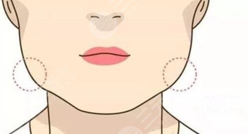 削骨瘦臉前后對比照大公開！對臉型的改變可能會出乎意料！變小臉~