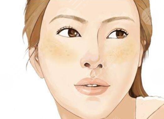 激光緩解黃褐斑多少錢一個療程？技術(shù)原理剖析，術(shù)后護理注意事項告知！