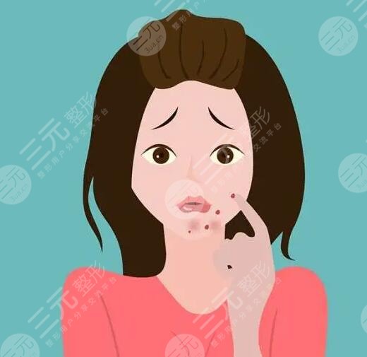 　　如何快速去青春痘?對(duì)于青春期的男生和女生們來(lái)講，大多數(shù)人都難逃青春痘的困擾，青春痘嚴(yán)重的時(shí)候會(huì)影響到一個(gè)人的顏值，所以青春期的男生和女生們大多都在戰(zhàn)“痘”，可是在緩解痘痘的時(shí)候也需要選對(duì)方法，不要盲目的去除痘痘，以免對(duì)皮膚造成傷害，下面做一個(gè)護(hù)膚達(dá)人，就來(lái)帶大家深入的認(rèn)識(shí)一下，如何快速去除青春痘?被青春痘困擾的男生女生可以詳細(xì)來(lái)了解一下。  　　1、如何快速去青春痘?  　　日常生活中快速去除青春痘的方式，常見的有藥物緩解、激光緩解以及紅藍(lán)光照射等，可以根據(jù)自己的皮膚狀態(tài)選擇適合自己的去除青春痘方式。  　　(1)藥物緩解  　　皮膚上的青春痘可以在專業(yè)醫(yī)生指導(dǎo)下，使用紅霉素軟膏或者阿達(dá)帕林凝膠進(jìn)行緩解，這些藥膏能夠快速消除青春痘。但是需要在專業(yè)醫(yī)生指導(dǎo)下規(guī)范用藥，不要盲目的使用，以免對(duì)皮膚造成傷害。  　　(2)激光緩解  　　激光緩解青春痘是醫(yī)療美容界的一種新型祛痘方式，激光緩解青春痘的原理，主要通過(guò)激光儀器所發(fā)出的高能熱量穿透皮膚表皮層，直接作用在皮膚基底層，這種熱量能夠促進(jìn)皮膚深層細(xì)胞組織生長(zhǎng)，從而可以讓皮膚上的青春痘逐漸修復(fù)，可以讓皮膚恢復(fù)到光滑平整的目的。  　　(3)紅藍(lán)光照射  　　紅藍(lán)光照射緩解青春痘，主要采用專業(yè)儀器發(fā)出的紅光熱效應(yīng)和藍(lán)光熱效應(yīng)對(duì)皮膚進(jìn)行交替照射，緩解皮膚上青春痘的同時(shí)還可以消除皮膚上的炎癥，是緩解青春痘的一種不錯(cuò)的方式。  　　2、青春痘是怎樣形成的?  　　青春痘大多是因?yàn)槊移ぶ傺装Y性病變導(dǎo)致的，因?yàn)樯眢w的內(nèi)分泌失調(diào)，導(dǎo)致雄激素水平偏高，從而誘發(fā)皮脂腺分泌增多，同時(shí)毛孔角化排出也不夠順暢，從而就形成了脂肪酸，繼發(fā)細(xì)菌感染的時(shí)候就會(huì)形成青春痘。另外在日常生活中長(zhǎng)時(shí)間喝酒，或者總是吃一些高脂肪飲食，或者是日常生活中總是長(zhǎng)時(shí)間熬夜也會(huì)導(dǎo)致青春痘生長(zhǎng)。需要注意的是青春痘并不一定是發(fā)生在青春期的，通常現(xiàn)在大多數(shù)人因?yàn)樯罟?jié)奏加快，成年人長(zhǎng)青春痘也不少見，并且比青春期長(zhǎng)的青春痘要比較頑固和復(fù)雜。  　　3、怎樣防止青春痘?  　　想要防止青春痘，在日常生活中要養(yǎng)成良好的飲食習(xí)慣和規(guī)律作息，平時(shí)飲食盡量少吃吃熱量比較高和脂肪含量比較高的食物，飲食可以以清淡食物為主，可以適當(dāng)?shù)亩喑砸恍┬迈r的蔬菜和水果，多喝一些溫開水，補(bǔ)充身體所需要的維生素和微量元素，防止身體便秘。另外還要適當(dāng)?shù)募訌?qiáng)體育運(yùn)動(dòng)，讓身體適當(dāng)?shù)亩喑鲆恍┖?。除此之外要養(yǎng)成良好的規(guī)律作息，每天保持充足的睡眠，不要長(zhǎng)時(shí)間熬夜，避免有太大的精神壓力和過(guò)于抑郁的情緒。