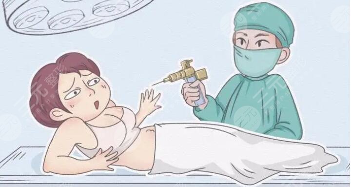 抽脂肪對(duì)身體有什么副作用？抽脂肪術(shù)后會(huì)反彈嗎？怎么護(hù)理為宜？