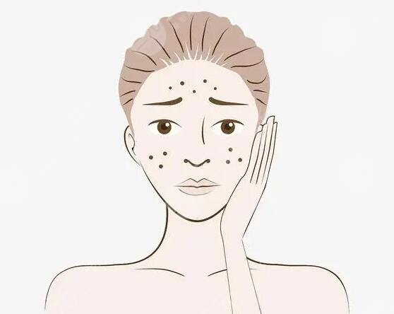 快速美白祛斑的方法是什么?
