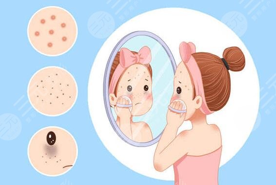 斑點是怎樣形成的?