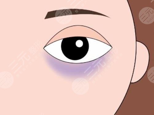 有黑眼圈是怎么回事？先天遺傳、后天因素導(dǎo)致的原因分析，該怎么有效避免？