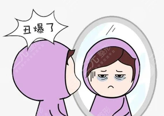 如何去除黑眼圈呢?