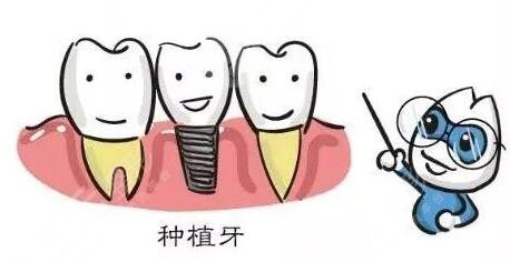 做種植牙的利與弊有哪些?