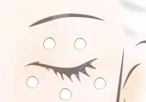 眼周圍有脂肪粒怎么引起的？