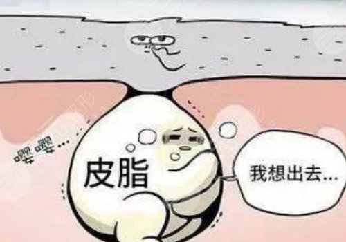 眼周圍有脂肪粒怎么引起的？