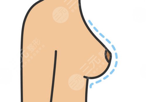 奧美定取出手術(shù)后要注意些什么？