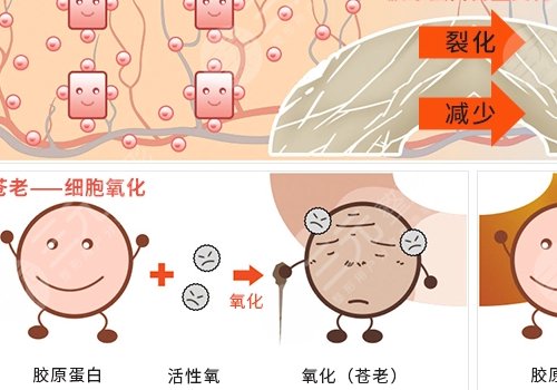 薇旖美三型膠原蛋白價格是多少？