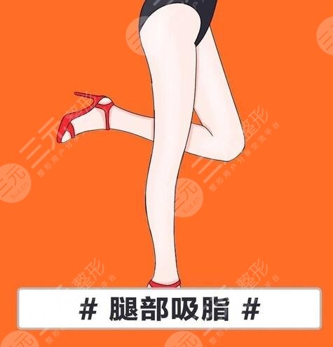 腿部吸脂減肥是什么?