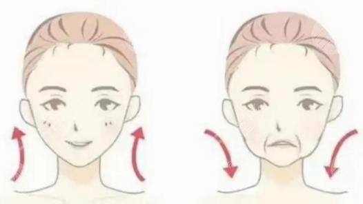 筋膜提升術(shù)