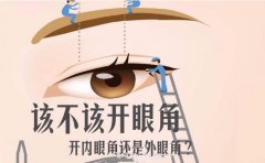 開眼角手術(shù)方法有哪些？3種常用術(shù)式圖解！