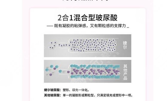 婕爾玻尿酸能維持多久？多少錢？