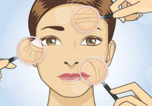 如何去除抬頭紋？