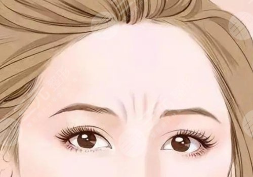 如何去除抬頭紋？