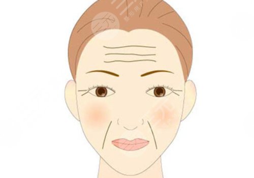 如何去除抬頭紋？