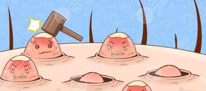 快速祛痘小竅門有哪些？外防內(nèi)治讓效果更徹底！找對長痘根源才是關(guān)鍵！