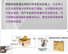黑臉娃娃有什么效果和作用？醫(yī)美干貨小課堂，帶你了解ta！
