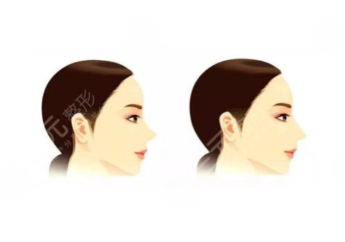 南昌佳美美容醫(yī)院正規(guī)嗎?