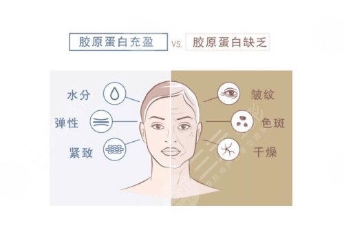 膠原蛋白填充臉部多少錢？