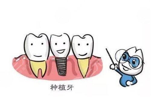 種植牙可以用社?？▓?bào)銷嗎？