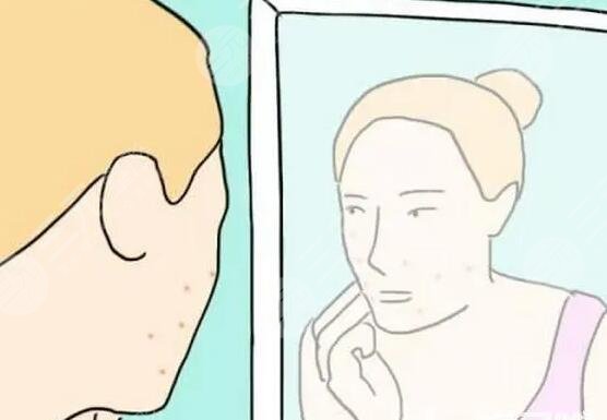 緩解青春痘的價格因素