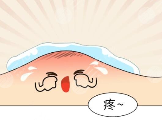 緩解青春痘的價格因素