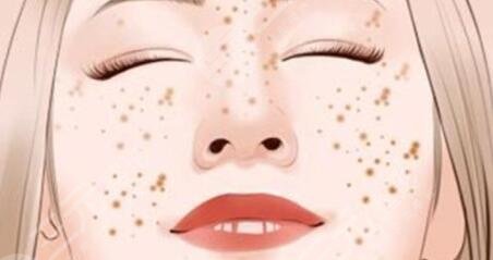 關(guān)于祛斑的方法有哪些是正確的？有效方法大全、看看哪種是你的菜~