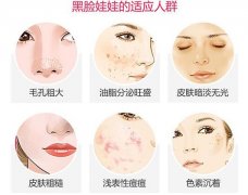 黑臉娃娃改良色素沉著怎么樣，有用嗎？碳粉美容，科普帶你了解！