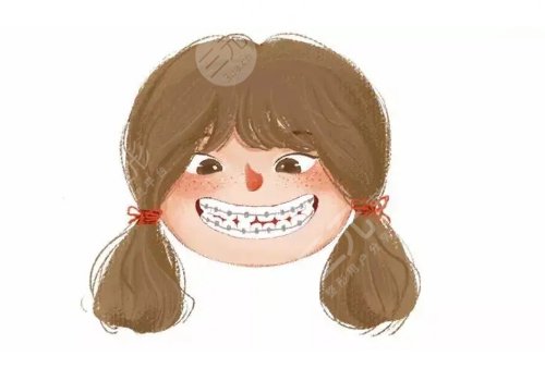 牙齒矯正用隱形牙套還是鋼絲牙套好？