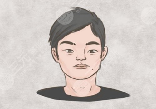 山根有橫紋是怎么回事？