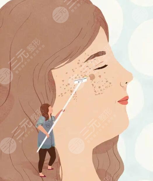 激光去色斑后還會復(fù)發(fā)嗎?